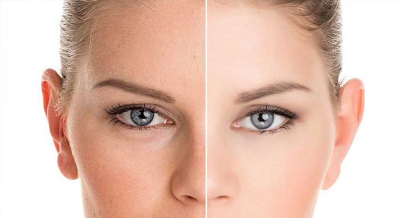 Skinbooster/hidratação profunda em curitiba - Odontologia Curitiba